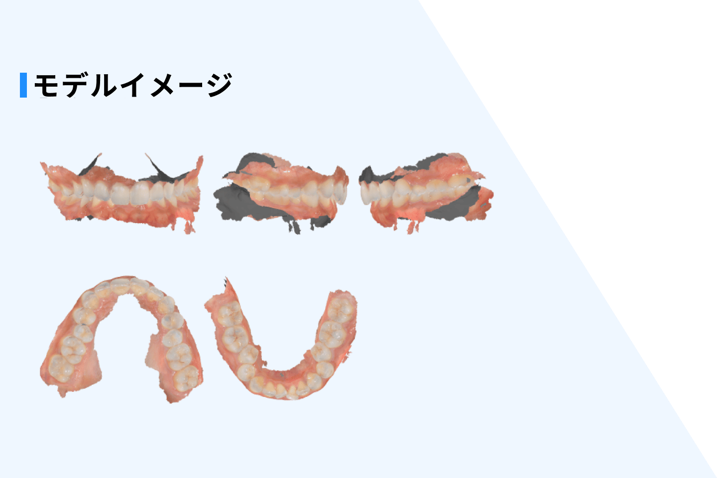 オーラルヘルスレポートのイメージ2