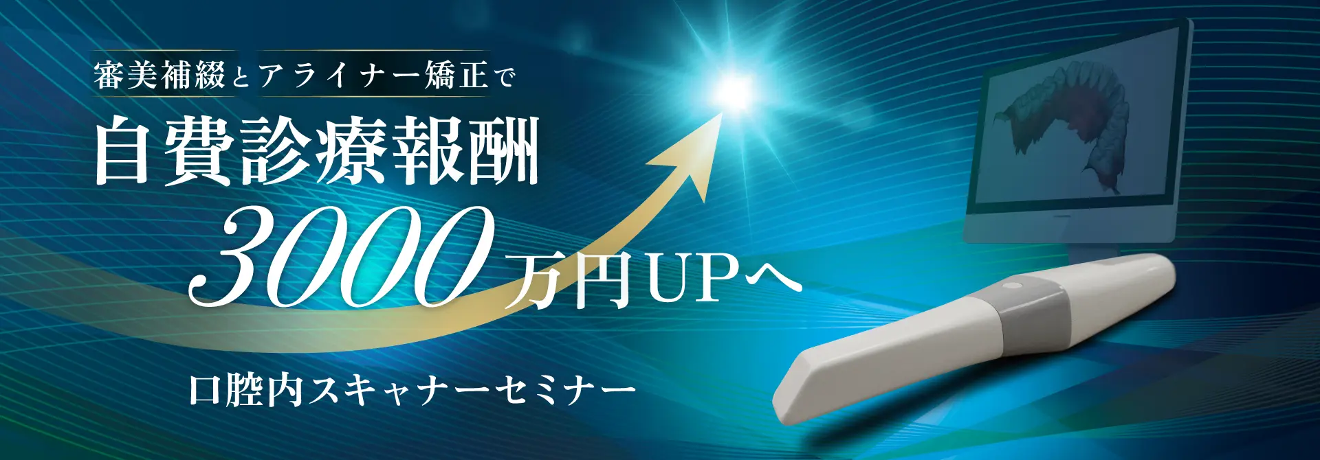 令和6年6月1日よりCAD/CAM インレーの光学印象保険適用開始！2種類の保険適用機種のご案内：WE SCAN、Runyes