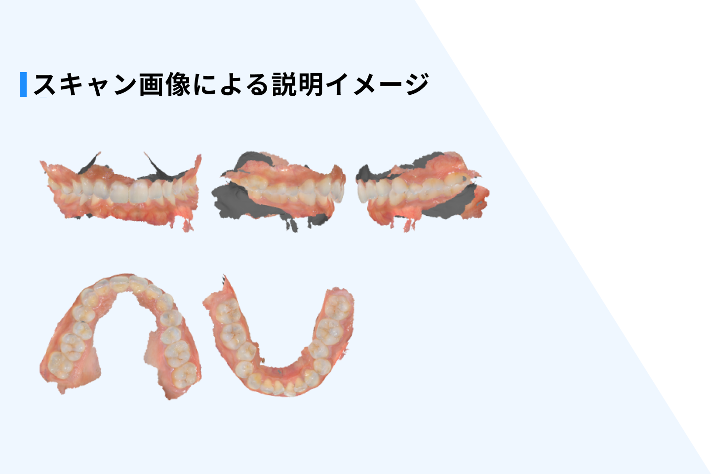 スキャン画像による説明イメージ